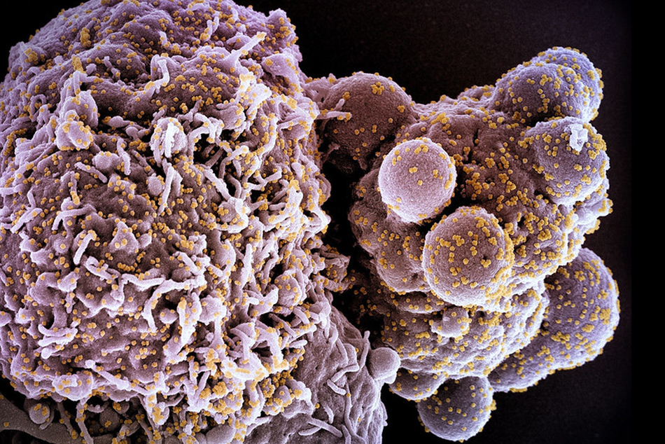  Colorized scanning electron micrograph of a cell (pink) infected with the Omicron strain of SARS-CoV-2 virus particles (yellow), isolated from a patient sample. Image captured at the NIAID Integrated Research Facility (IRF) in Fort Detrick, Maryland. Credit: NIAID