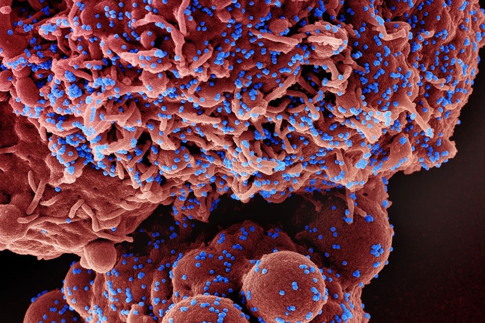  Colorized scanning electron micrograph of a cell (red) infected with the omicron strain of SARS-CoV-2 virus particles (blue), isolated from a patient sample. Image captured at the NIAID Integrated Research Facility (IRF) in Fort Detrick, Maryland. NIAID