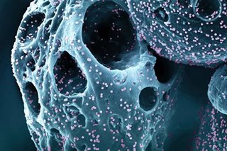 DOH: 711 new cases of omicron subvariants detected