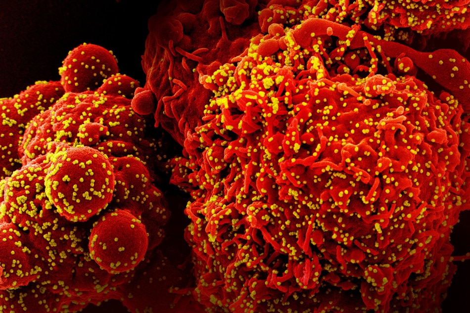 Colorized scanning electron micrograph of a cell (red) infected with the Omicron strain of SARS-CoV-2 virus particles (yellow), isolated from a patient sample. Image captured at the NIAID Integrated Research Facility (IRF) in Fort Detrick, Maryland. Credit: NIAID