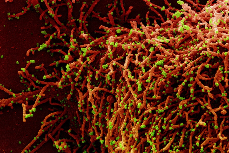 Colorized scanning electron micrograph of a cell (red) infected with a variant strain of SARS-CoV-2 virus particles (green), isolated from a patient sample. Image captured at the NIAID Integrated Research Facility (IRF) in Fort Detrick, Maryland. Credit: NIAID