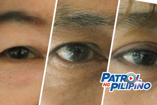 Paano mapapanatiling healthy ang paningin?