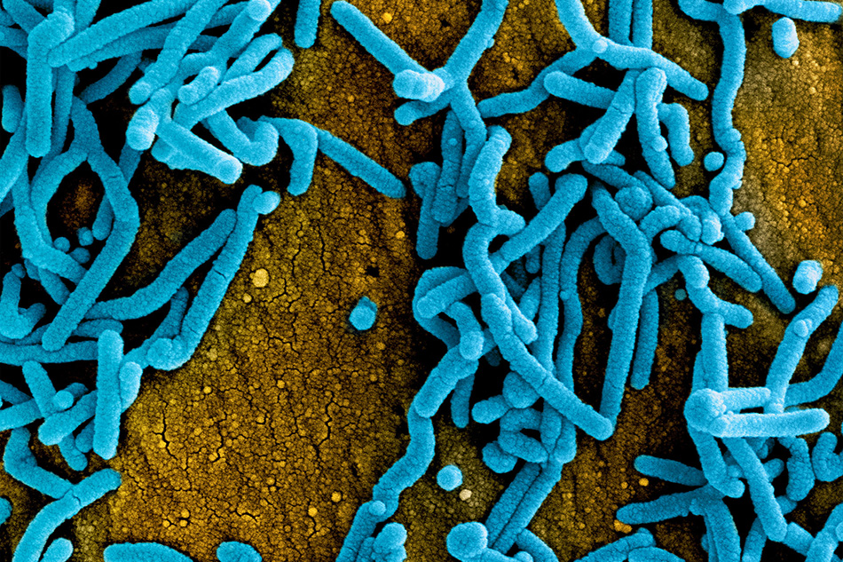Colorized scanning electron micrograph of Marburg virus particles (blue) both budding and attached to the surface of infected VERO E6 cells (orange). Image captured and color-enhanced at the NIAID Integrated Research Facility in Fort Detrick, Maryland. Credit: NIAID
