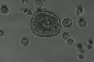 Scientists build biological robots from human cells