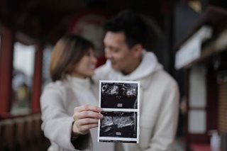 Scottie Thompson, wife Jinky expecting first child