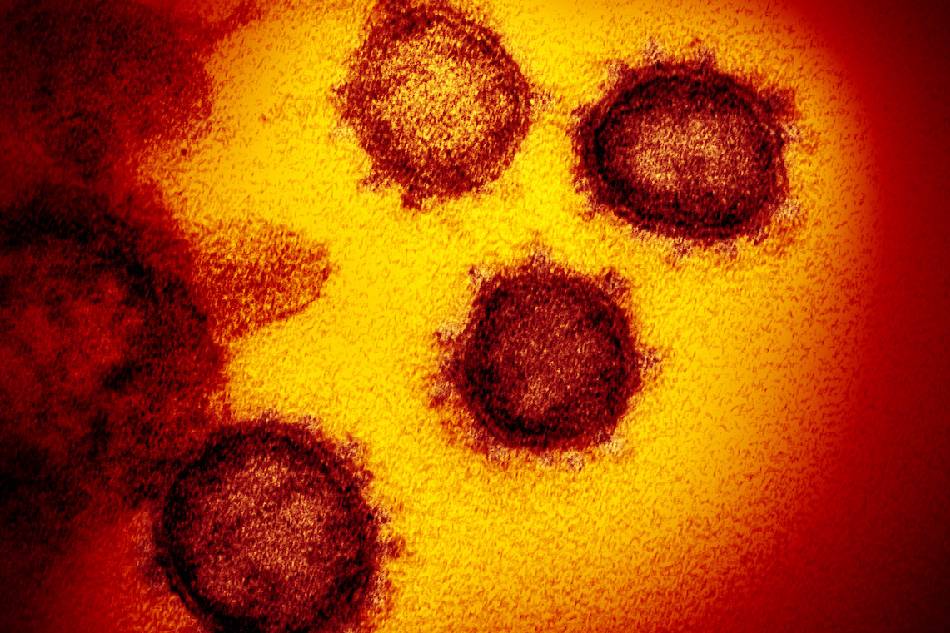 This transmission electron microscope image shows SARS-CoV-2, the virus that causes COVID-19, isolated from a patient in the US, emerging from the surface of cells cultured in the lab. NIAID-RML