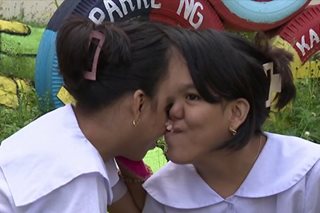 KBYN: Inspirasyon hatid ng conjoined twins