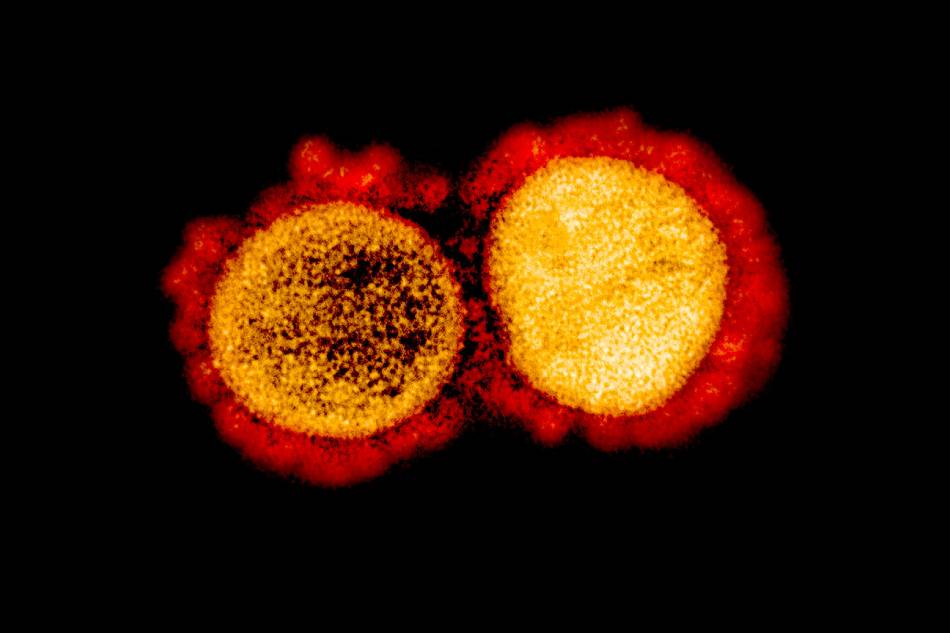 Transmission electron micrograph of SARS-CoV-2 virus particles, isolated from a patient. Image captured and color-enhanced at the NIAID Integrated Research Facility (IRF) in Fort Detrick, Maryland. Credit: NIAID
