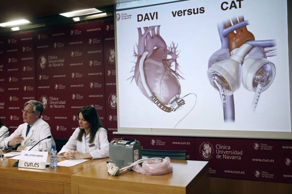 University Clinic of Navarra chief of surgery Gregorio Rabago (L) explains how the artificial heart works during a press conference in Pamplona, Spain on Dec. 2, 2016. Jesus Diges, EPA/File